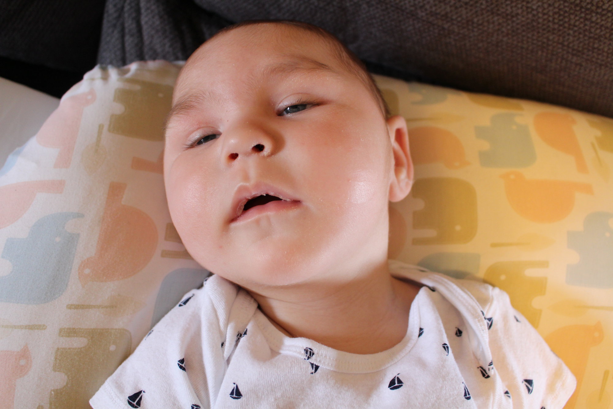 Félip without his feeding tube